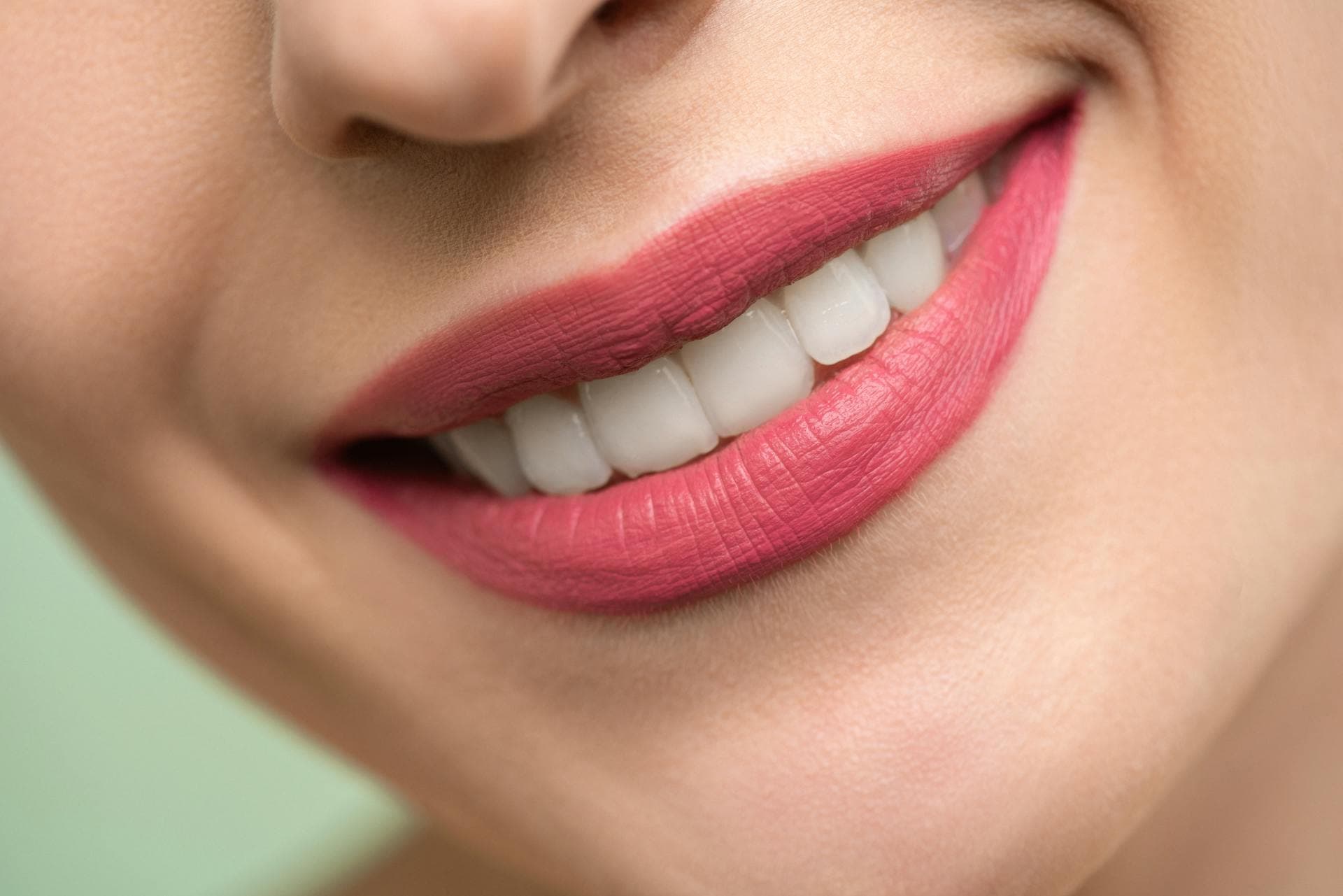 Cosmetic veneers at Shine Dental Newington