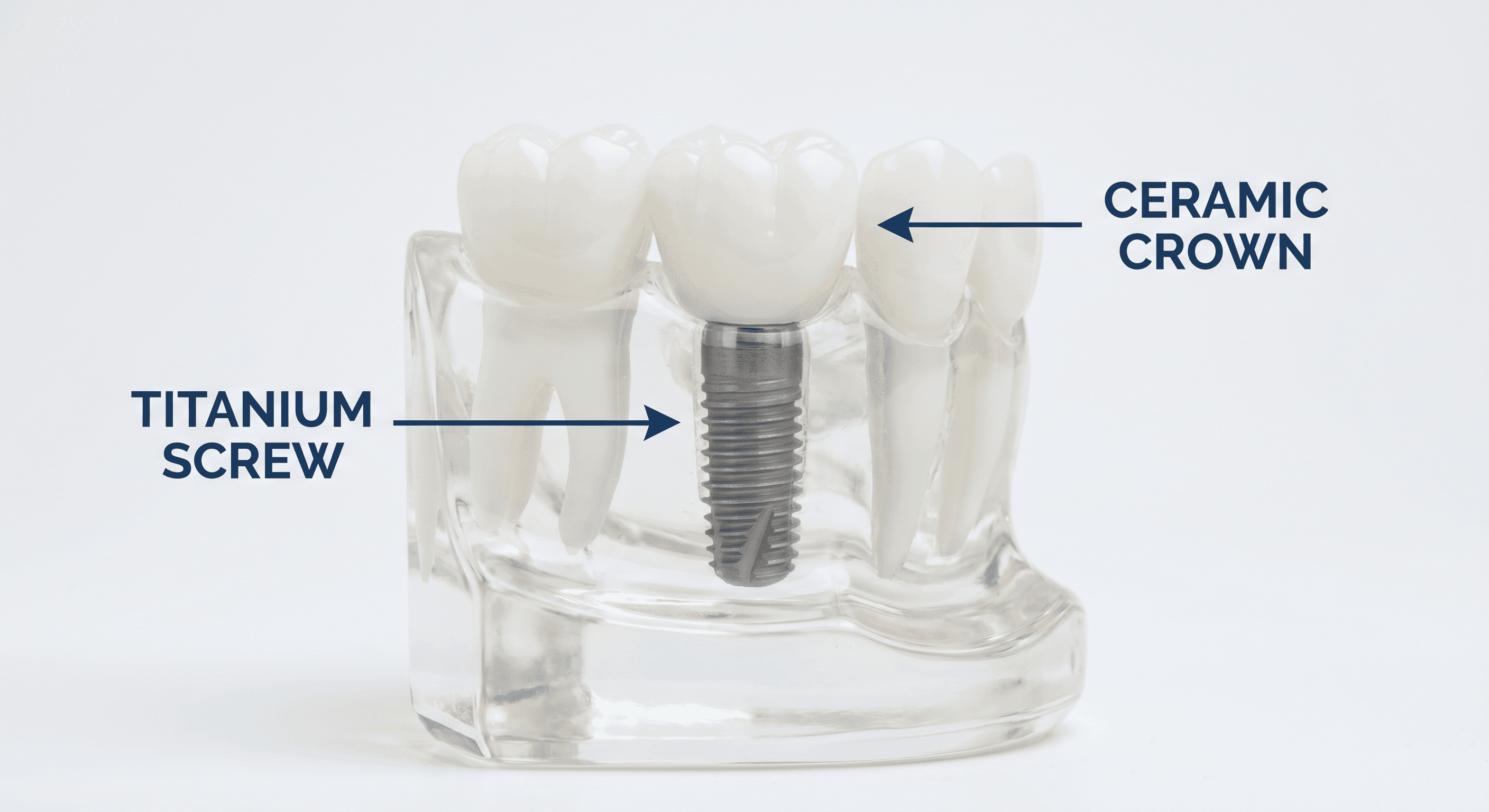 Missing Teeth: The Health Consequences You Need to Know