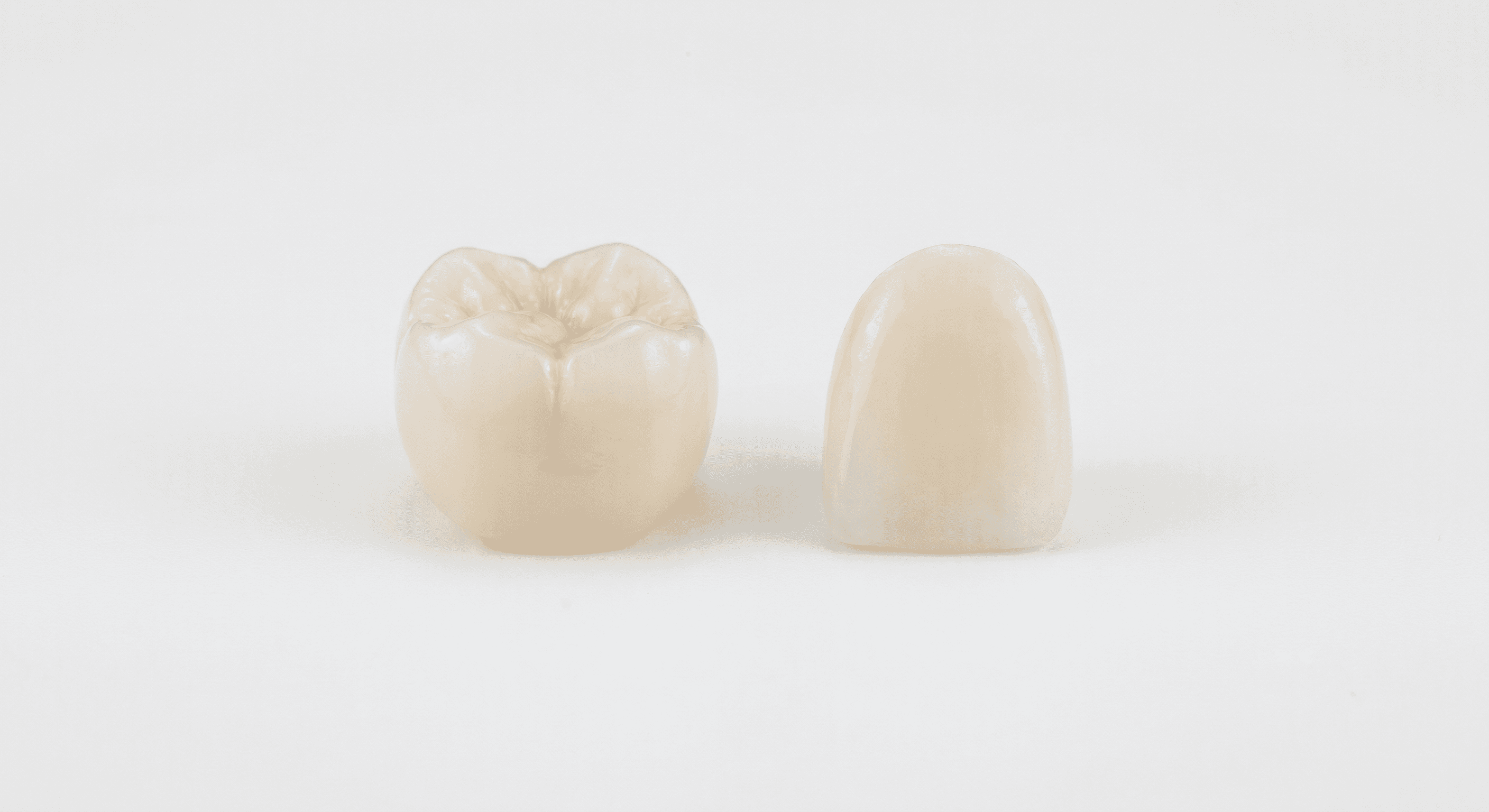 Dental Crown vs Veneer: Which Is Right for Your Tooth?