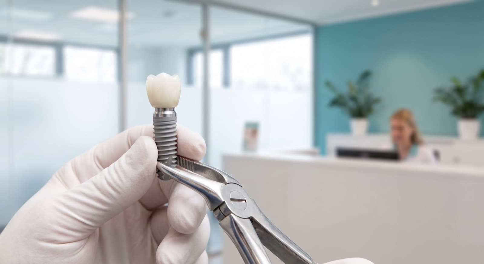 Dental Implants for Lidcombe Residents: Experienced Care 10 Minutes from Home